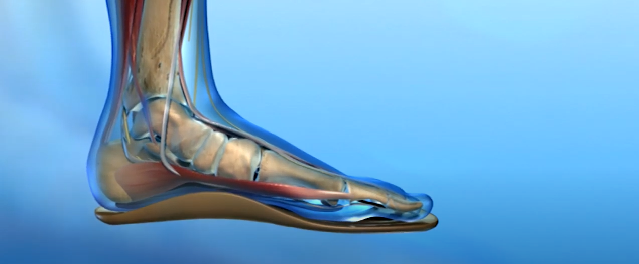 insole for diabetics insole for diabetics